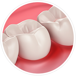 Gum Health and Sensitivity Gum Health and Sensitivity